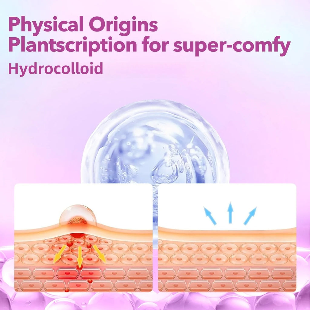Starry Pimple Patches (280 ct) ⭐🌸 | Hydrocolloid Acne Patches for Overnight Blemish Care